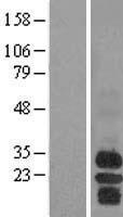 BAFF Receptor (TNFRSF13C) Human Over-expression Lysate