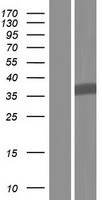 GNB1L Human Over-expression Lysate