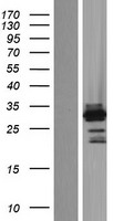 OSR2 Human Over-expression Lysate
