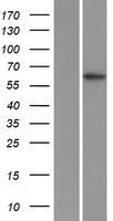 ZFP91 Human Over-expression Lysate
