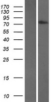 Transglutaminase 7 (TGM7) Human Over-expression Lysate