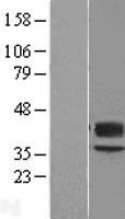 CD57 (B3GAT1) Human Over-expression Lysate