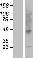 AMAC1L2 (SLC35G5) Human Over-expression Lysate
