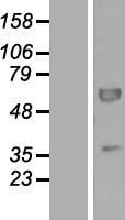 PEX16 Human Over-expression Lysate