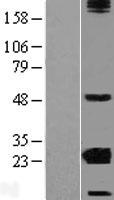 CRYBA2 Human Over-expression Lysate