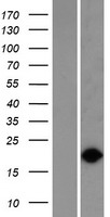 VPS29 Human Over-expression Lysate
