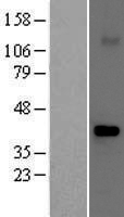 Fbx32 (FBXO32) Human Over-expression Lysate