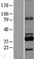 RPUSD1 Human Over-expression Lysate