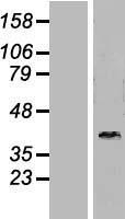 DNAJB6 Human Over-expression Lysate