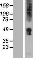 SLC36A1 Human Over-expression Lysate