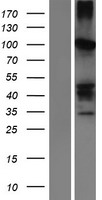 SERPINB11 Human Over-expression Lysate