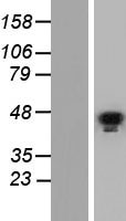 GATA5 Human Over-expression Lysate