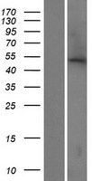 ABHD16B Human Over-expression Lysate