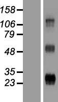 WFDC3 Human Over-expression Lysate