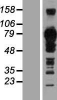 TJAP1 Human Over-expression Lysate