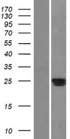 C20orf70 (BPIFA2) Human Over-expression Lysate