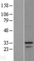 C9orf30 (MSANTD3) Human Over-expression Lysate