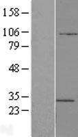 ATP6V1E2 Human Over-expression Lysate
