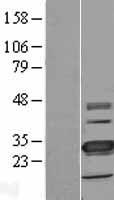 TMEM41A Human Over-expression Lysate
