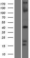 TBX1 Human Over-expression Lysate