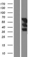 UPF3B Human Over-expression Lysate