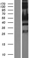 UPF3A Human Over-expression Lysate