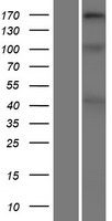 Collagen XI alpha 2 (COL11A2) Human Over-expression Lysate