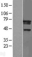 NCE2 (UBE2F) Human Over-expression Lysate