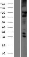 TMC2 Human Over-expression Lysate