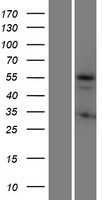 KRT72 Human Over-expression Lysate