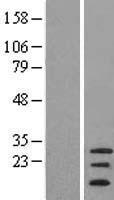 C20orf141 Human Over-expression Lysate