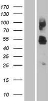 HCP1 (SLC46A1) Human Over-expression Lysate