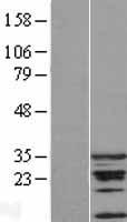 CDCA5 Human Over-expression Lysate