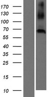 C20orf152 (CNBD2) Human Over-expression Lysate