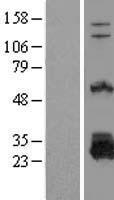 DTD1 Human Over-expression Lysate
