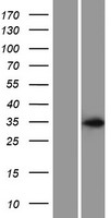 ASB17 Human Over-expression Lysate