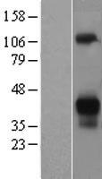 Asialoglycoprotein Receptor 2 (ASGR2) Human Over-expression Lysate