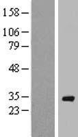 RAB40A Human Over-expression Lysate