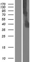 ITLN2 Human Over-expression Lysate