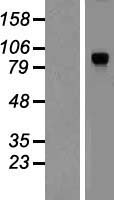 DYRK1A Human Over-expression Lysate