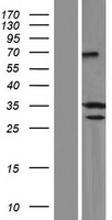 SYCE1 Human Over-expression Lysate
