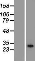 RGS18 Human Over-expression Lysate