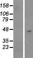 TSPAN17 Human Over-expression Lysate