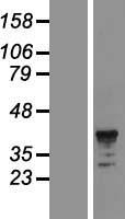 CD89 (FCAR) Human Over-expression Lysate