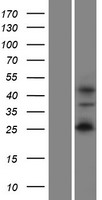 WIPF2 Human Over-expression Lysate