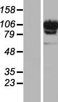 DIS3L Human Over-expression Lysate
