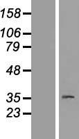 Progestin Receptor Beta (PAQR8) Human Over-expression Lysate