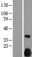 NEK7 Human Over-expression Lysate