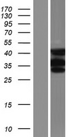MBNL3 Human Over-expression Lysate