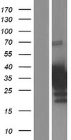 CITED4 Human Over-expression Lysate